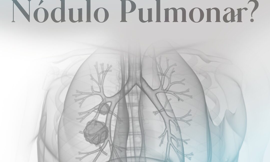 Nódulos pulmonares